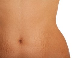 Best Homeo Clinic in Indirapuram